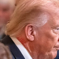 Red spots and bruises on Trump