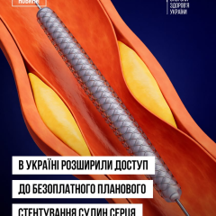 Людина отримує стентування серця безкоштовно