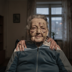 89-річна киянка вижила ракетний удар