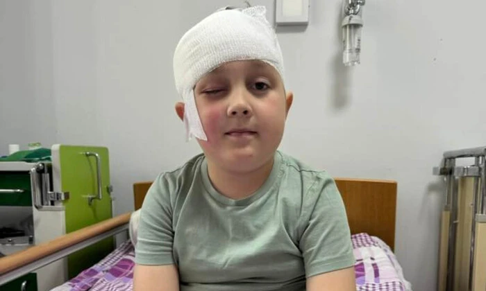 Surgeons removed tumor from boy