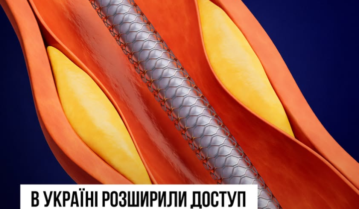 Людина отримує стентування серця безкоштовно